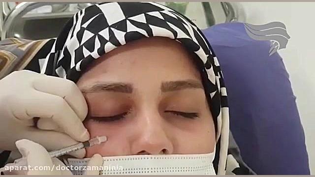 درمان پف و تیرگی زیرچشم با مزوتراپی رتروگناتیا