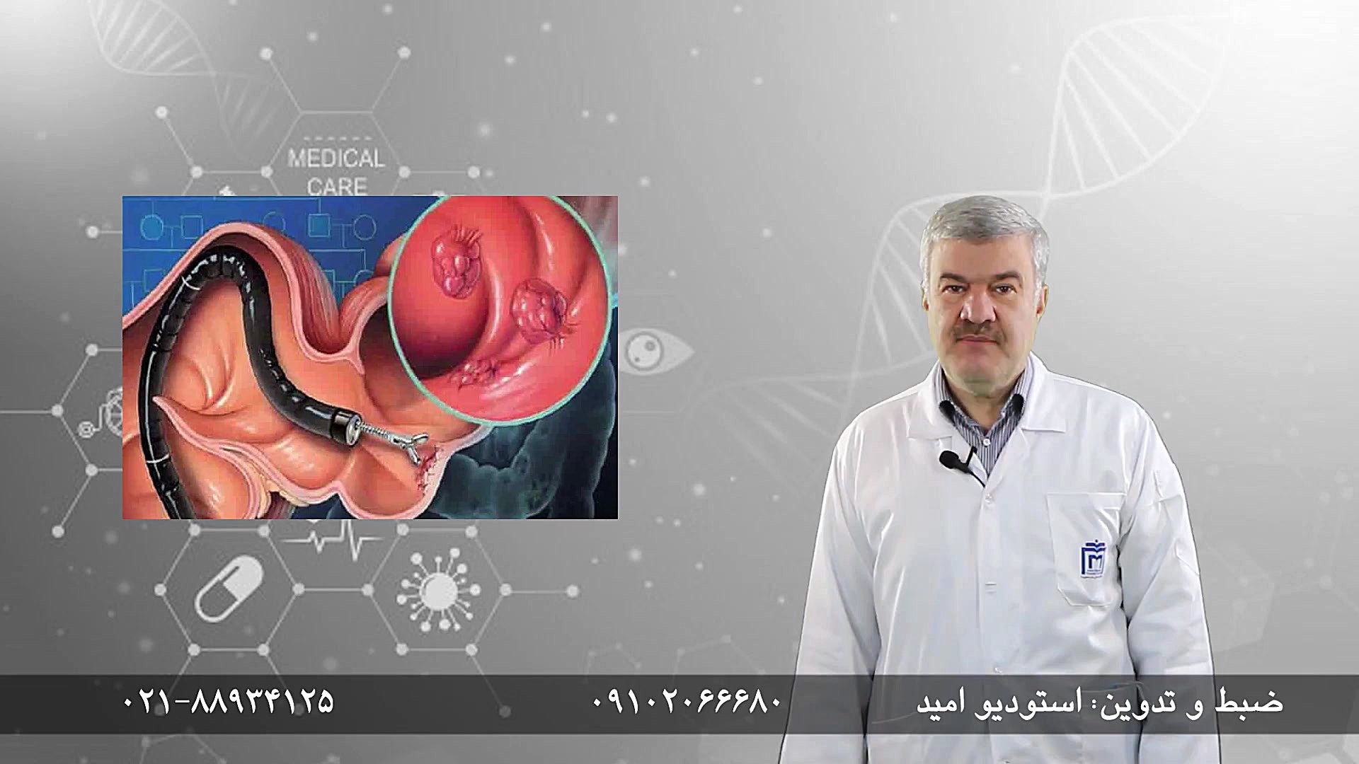 دکتر محمد جعفر فره وش(کولونوسکوپی) لیپوماتیک