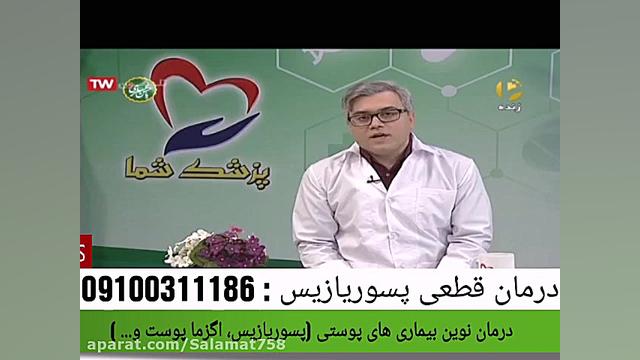 آیا بیماری پسوریازیس و اگزما پوست قابل درمان است؟ (پسوریازیس چیست) کلاغ آنلاین