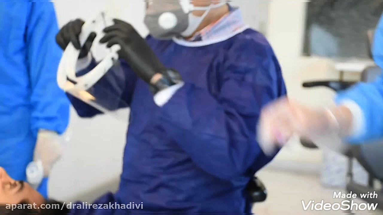 تنگی فک بالا در بیمار.متخصص ارتودنسی تهران.دکترعلیرضاخدیوی دکتر علیرضا خدیوی