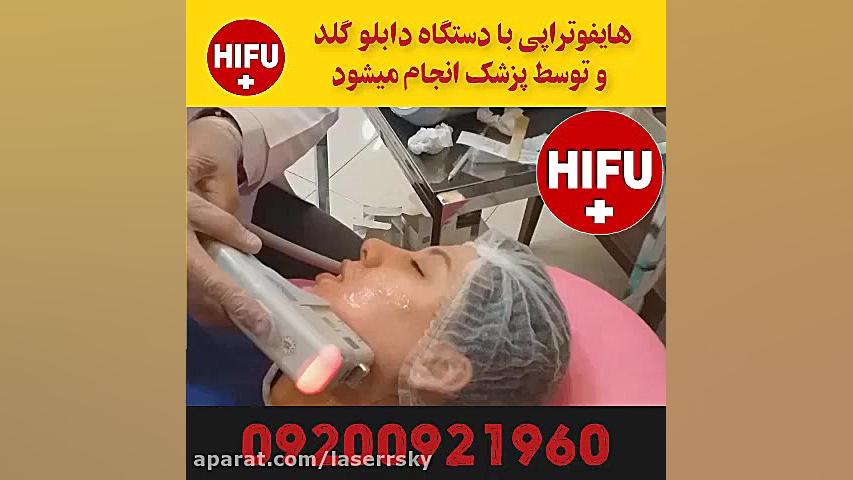 هایفوتراپی در غرب تهران ترمیم زیبایی دندان