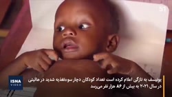 سوءتغذیه کودکان در هائیتی؛ یونیسف هشدار داد