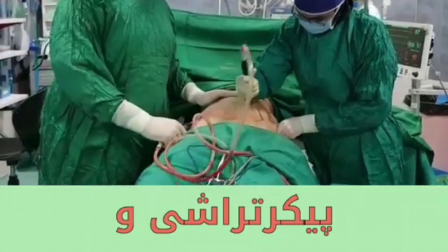 انجام عمل لیپوساکشن و ابدومینوپلاستی در مرکز جراحی محدود ایرانیان ChIP-Chip