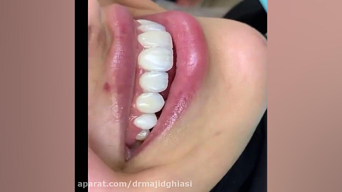 لبخند زیبا ؛ هدیه ما به شما دکترمجیدقیاسی