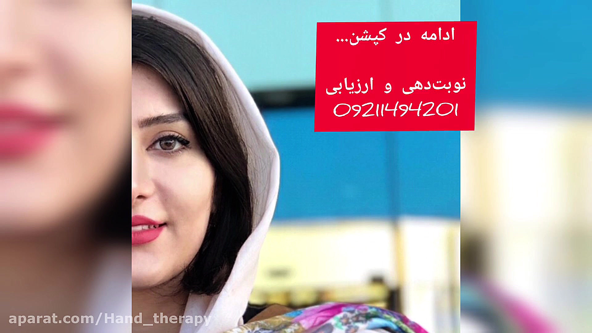 کاردرمانی دست در اسکلرودرمی _ صبازاهدپور چالش موزیکال