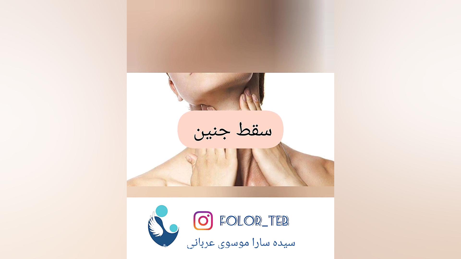 عوارض کم کاری تیروئید درمان نشده در بارداری سیده سارا موسوی عربانی