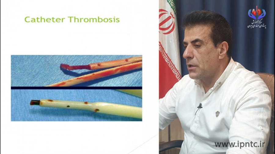 عوارض بلندمدت دیالیز -قسمت هشتم -دکتر علی طیبی کلاغ آنلاین