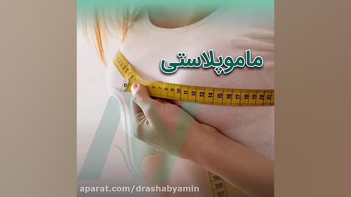 ماموپلاستی به روایت تصویر دکتر محمودرضا اصحاب یمین - فوق تخصص پلاستیک