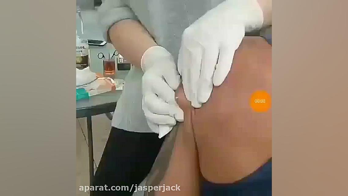 تخلیه کیست عفونی (لطفا اگر بر دلید نبینید) کامپوزیت ونیر