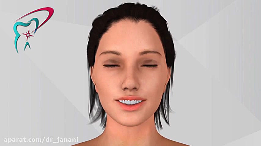 انیمیشن پر کردن دندان بروموکریپتین