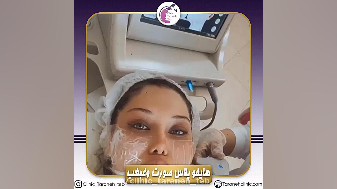 هایفوتراپی معجزه جوانسازی و لیفت صورت | هزینه و مزایاپا جراحی پف زیر چشم