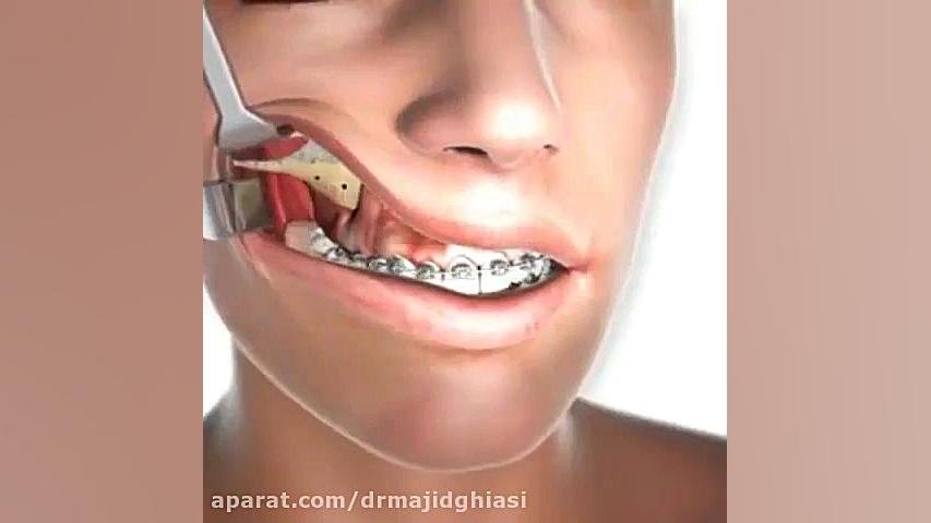 جراحی ارتودنسی دندان دکترمجیدقیاسی