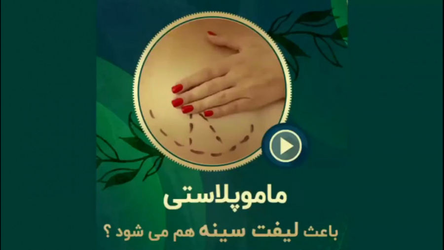 جراحی ماموپلاستی باعث لیفت سینه میشود؟ دکتر محمدرضا آخوندی نسب-فوق تخصص جراحی پلاستیک