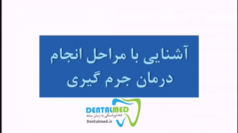 فیلم آشنایی با مراحل درمان جرم گیری ویژه آموزش دوره دستیار دندانپزشکی CUT&Tag
