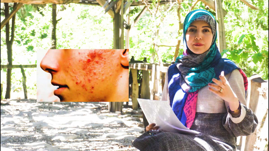 عوارض لیزر پوست مزوتراپی