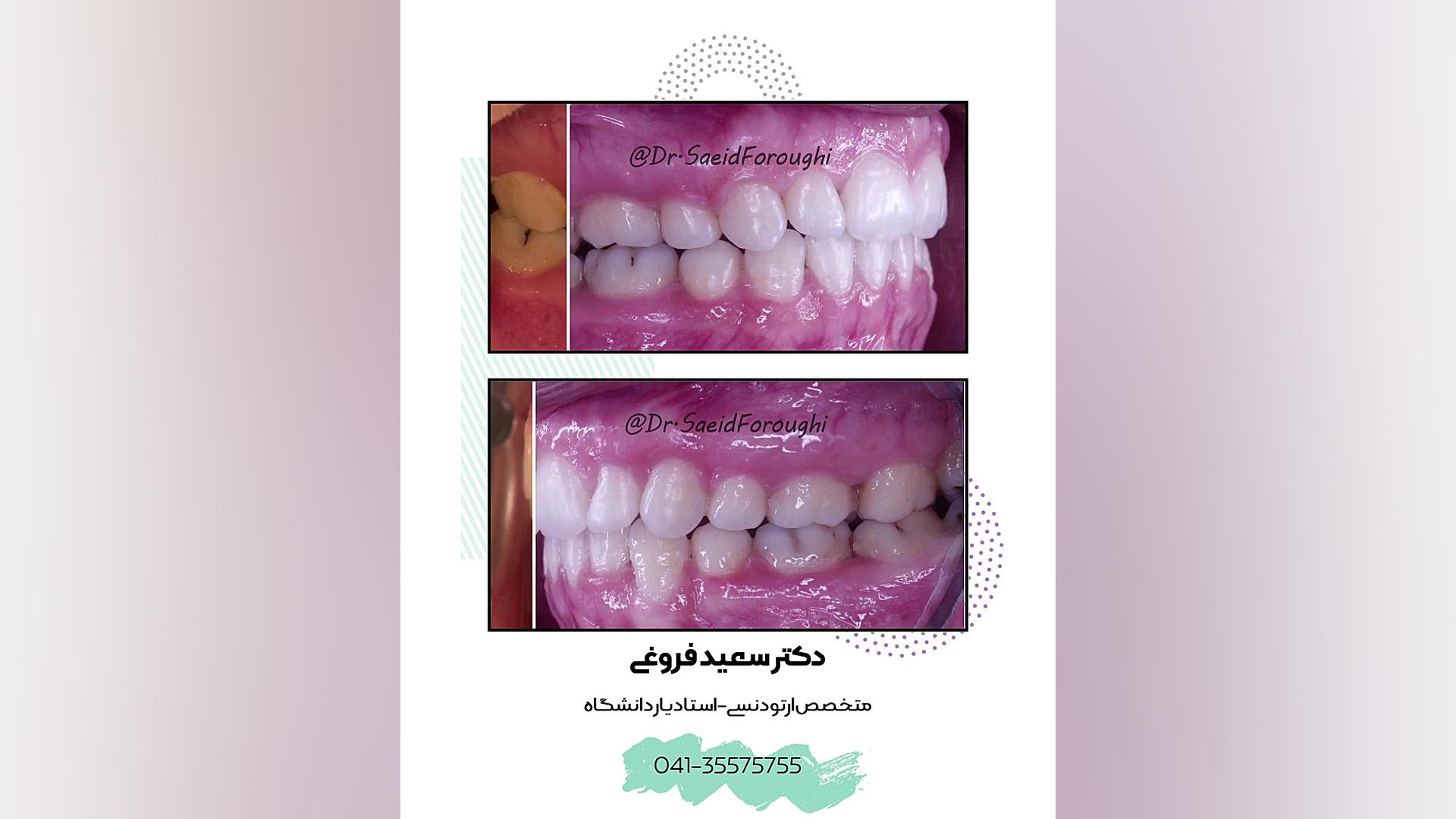 ارتودنسی دندان دکتر سعید فروغی متخصص ارتودنسی