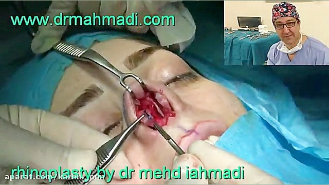بهترین جراح سر و گردن عمل زیبایی بینی15 دکتر مهدی احمدی