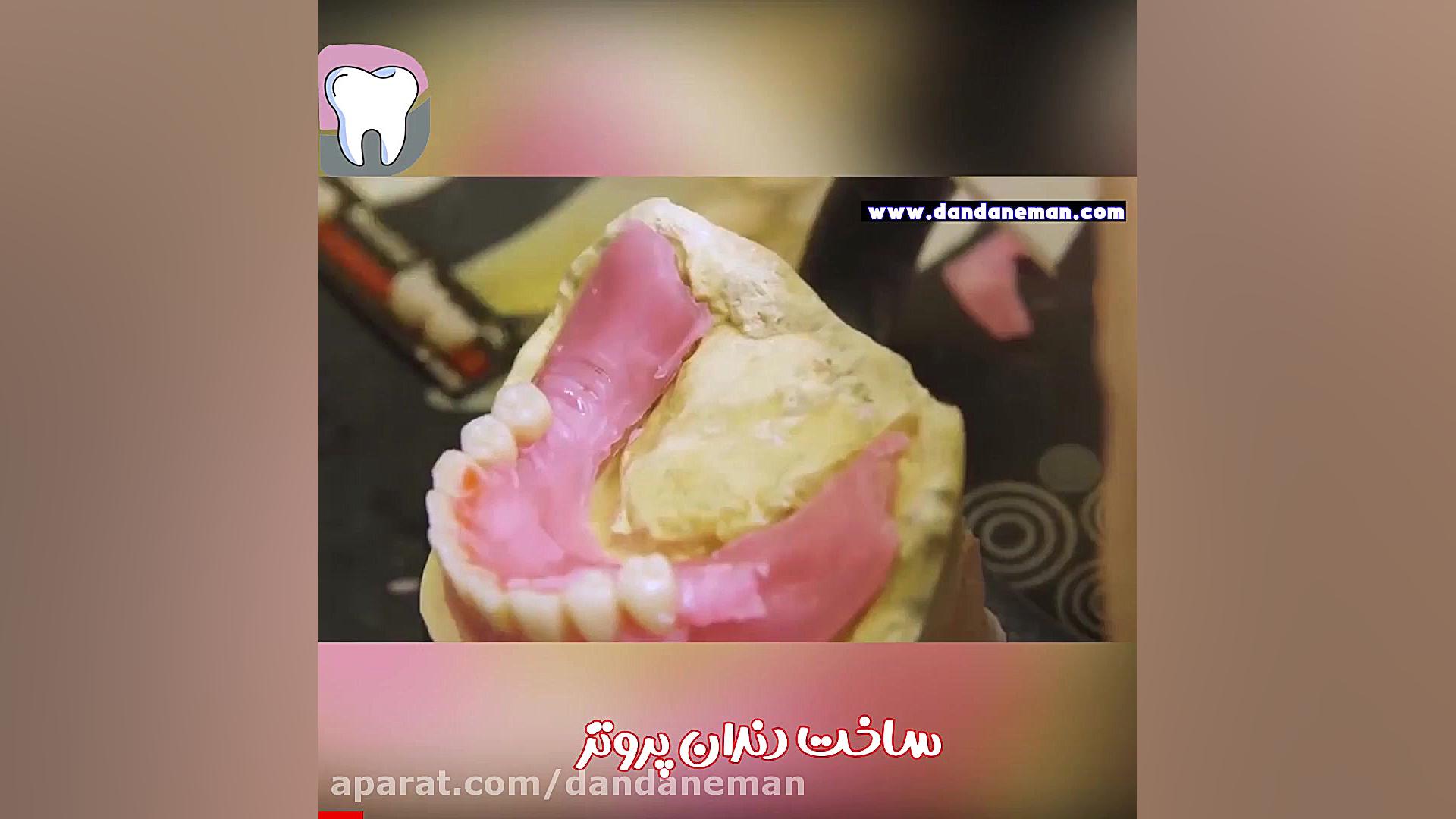 پروتر دندان والسارتان