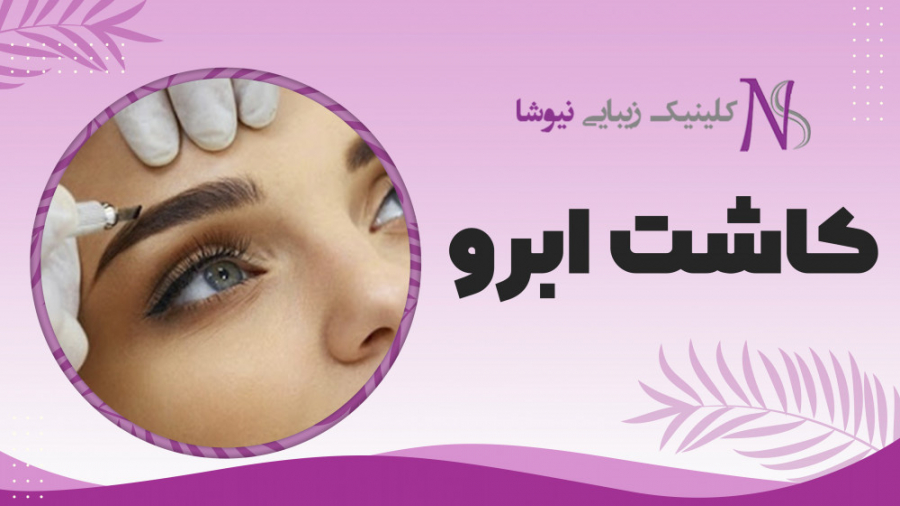 کاشت ابرو | کلینیک زیبایی نیوشا ANCA