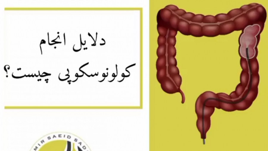 دلایل انجام کولونوسکوپی چیست؟ دکتر امیر سعید صادقی (فوق تخصص گوارش و کبد)
