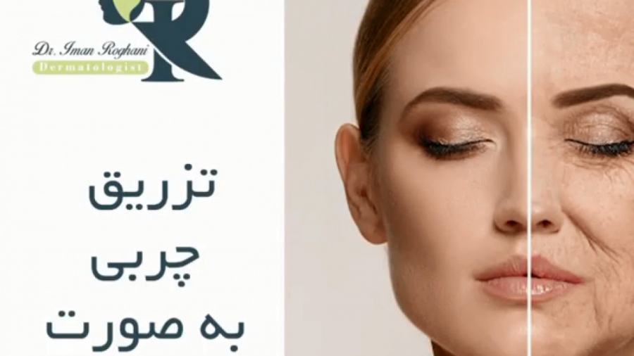 تزریق چربی به صورت دکتر ایمان روغنی جراح و متخصص پوست و مو