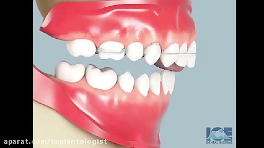 دکتر نیما شفیعی جراح لثه تزریق چربی