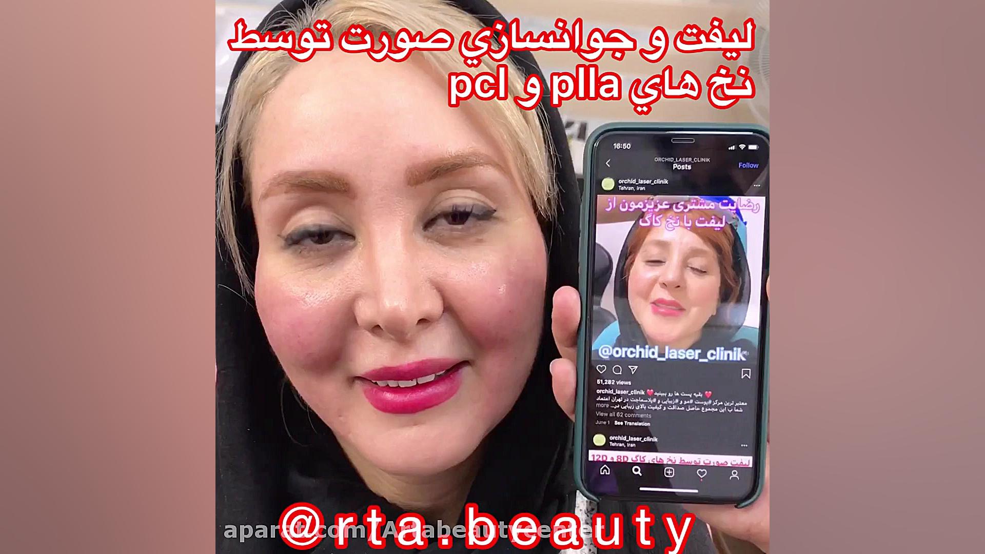 معجزه ليفت با نخ اندودنتیکس