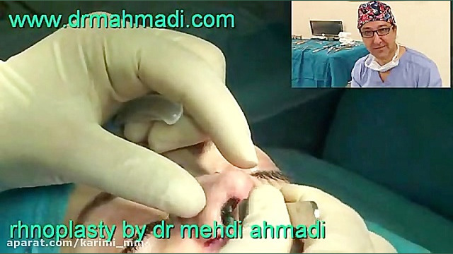 فیلم عمل جراحی زیبایی بینی 38 بهترین متخصص زیبایی دکتر مهدی احمدی