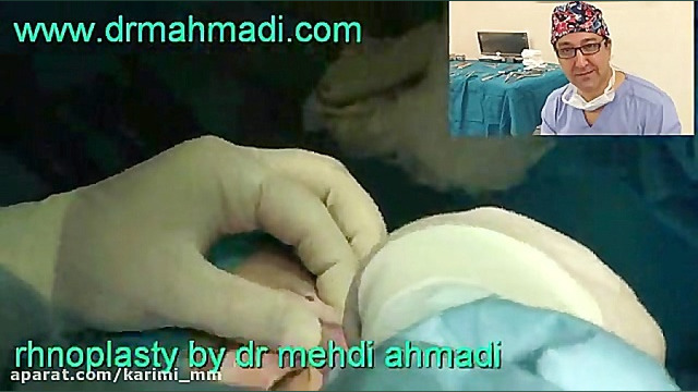 جراح بینی طبیعی خوب اقدسیه02188794098 دکتر مهدی احمدی