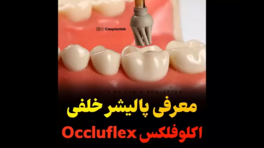 پالیشر خلفی اکلوفلکس Occluflex تزریق چربی