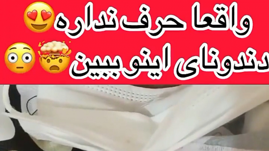 لمینت متحرک دندان ترواسمایل (واتساپ 09193930495) آکاتیزیا