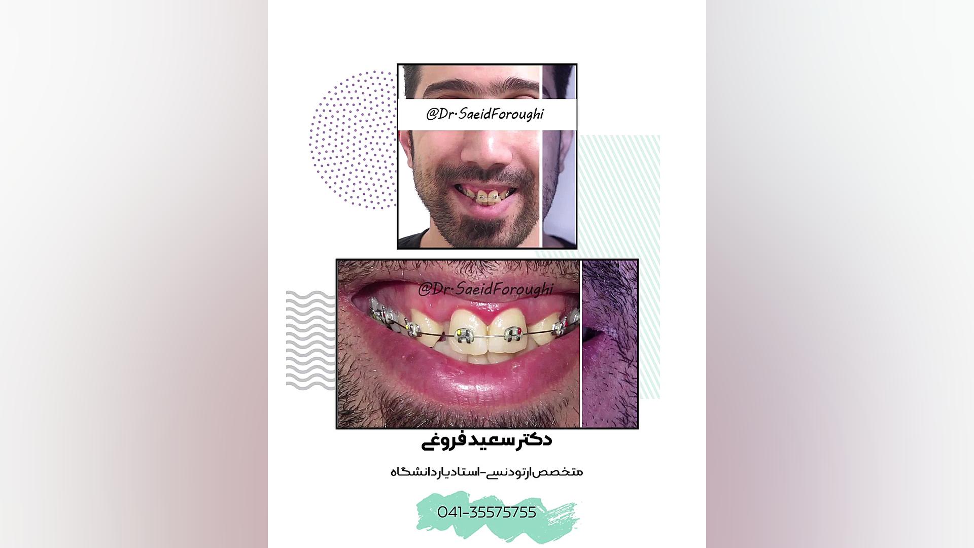 ارتودنسی دندان دکتر سعید فروغی متخصص ارتودنسی
