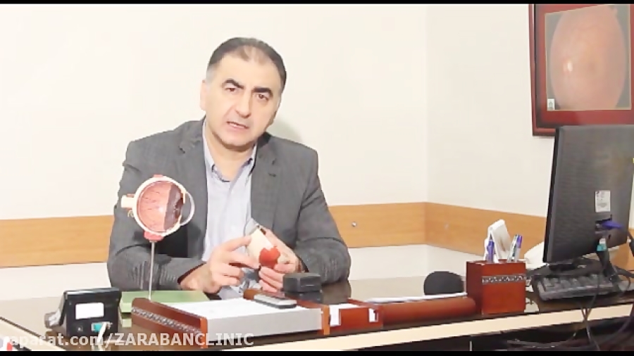 دکتر فرید کریمیان- قوز قرنیه دکتر فرید کریمیان