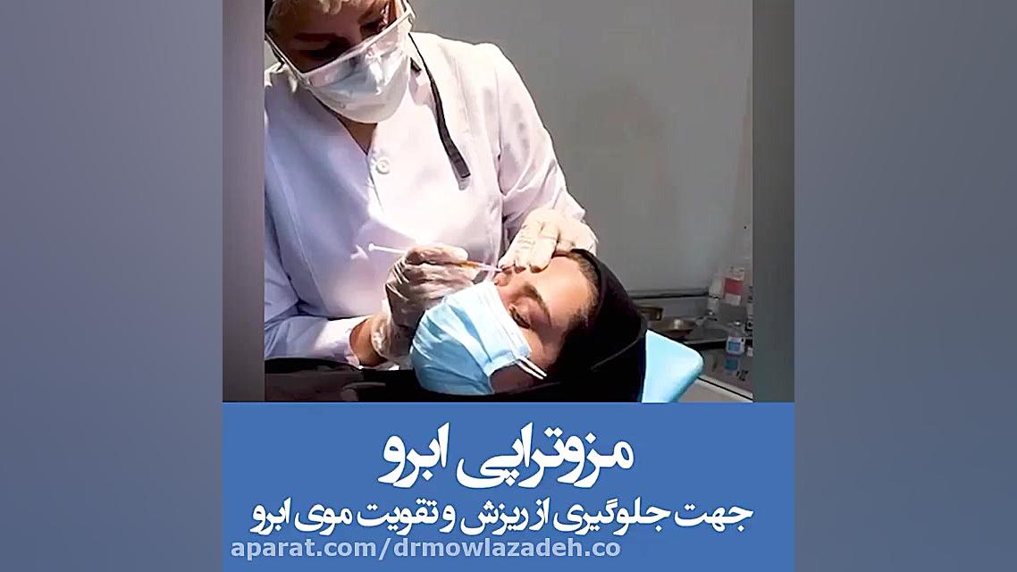 مزوتراپى ابرو جهت جلوگيرى از ريزش و تقویت موی ابرو پزشکی هیپر باریک