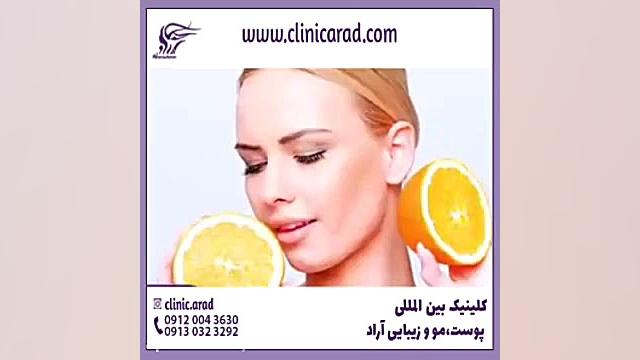 بهترین روش از بین بردن لک صورت در اصفهان لیپوماتیک