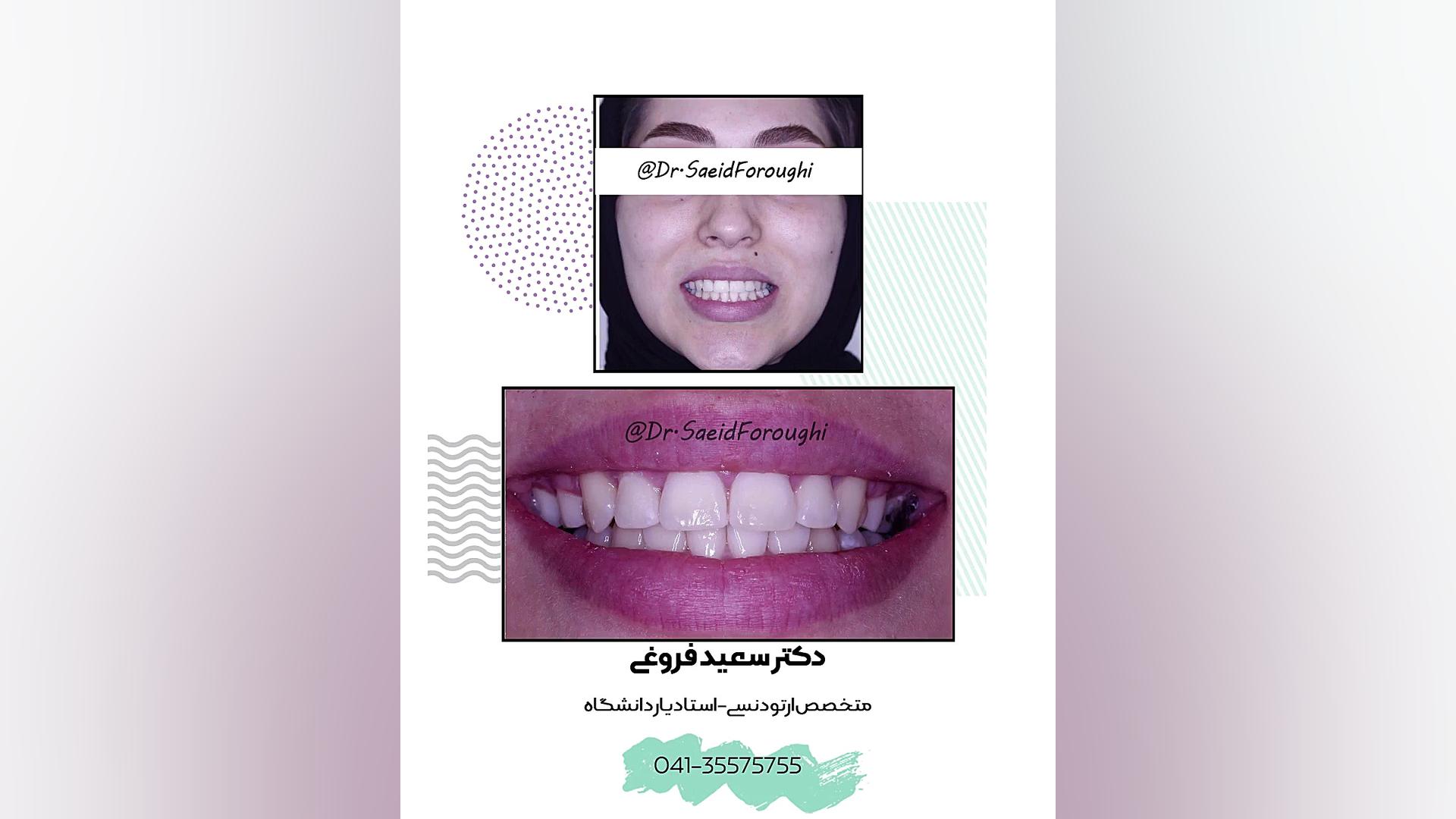 ارتودنسی دندان دکتر سعید فروغی متخصص ارتودنسی