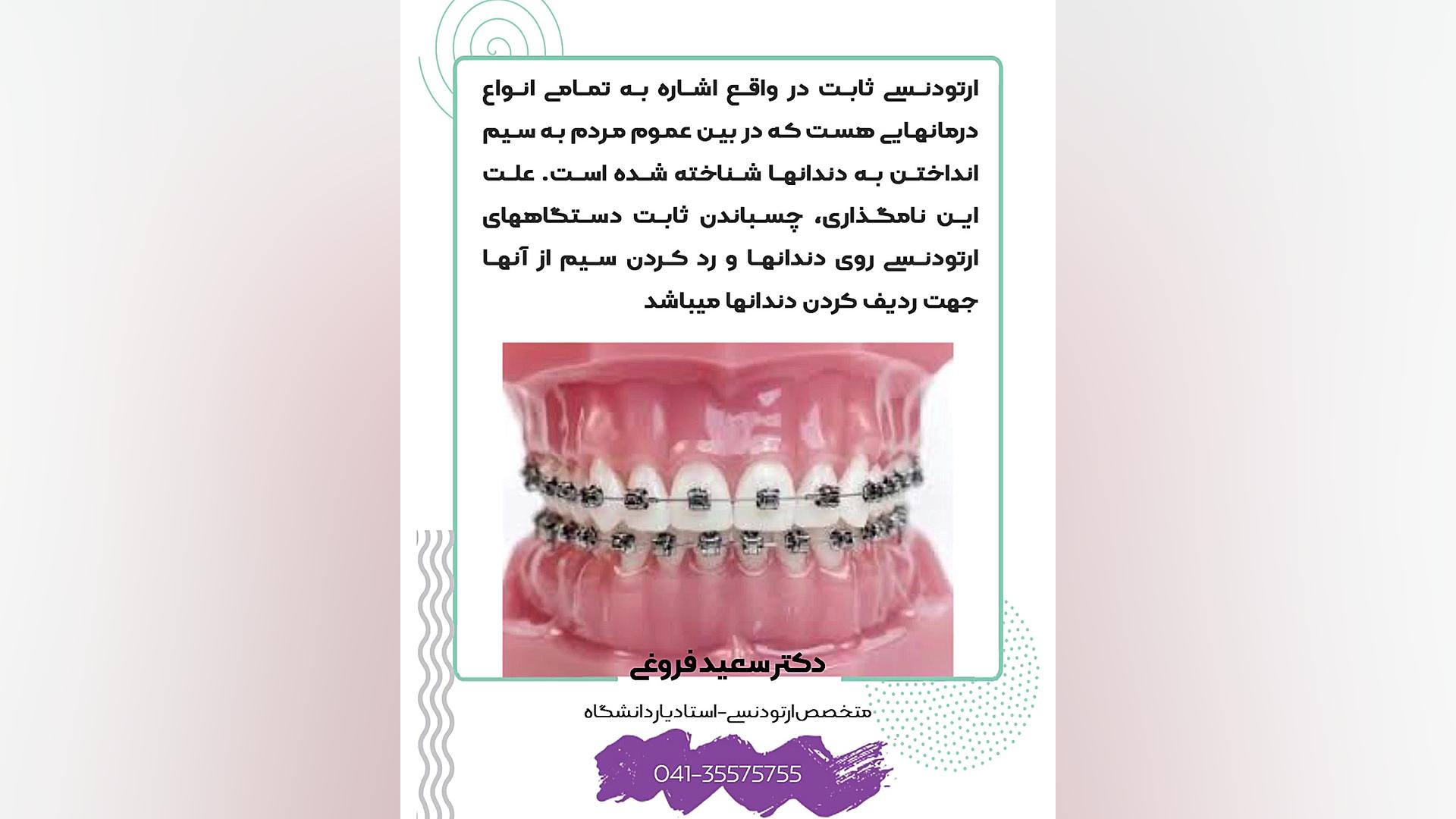 تفاوت ارتودنسی ثابت و متحرک دکتر سعید فروغی متخصص ارتودنسی