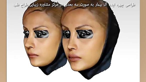 نمایش قبل و بعد از جراحی به صورت سه بعدی در طراح طب خرگوش اینستاگرامی