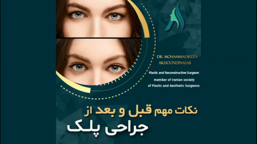 نکات مهم قبل و بعد از جراحی پلک دکتر محمدرضا آخوندی نسب-فوق تخصص جراحی پلاستیک