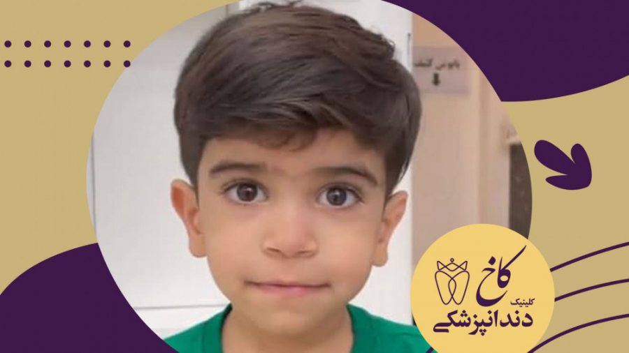دندانپزشکی با بیهوشی کودکان کلینیک دندانپزشکی کاخ