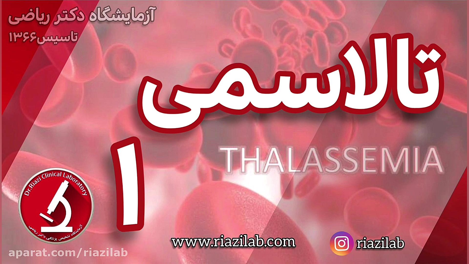 تالاسمی چیست / آزمایشگاه دکتر ریاضی لیفت پیشانی