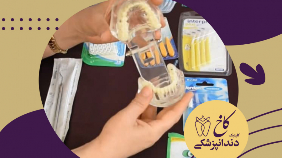 مسواک بین دندانی کلینیک دندانپزشکی کاخ