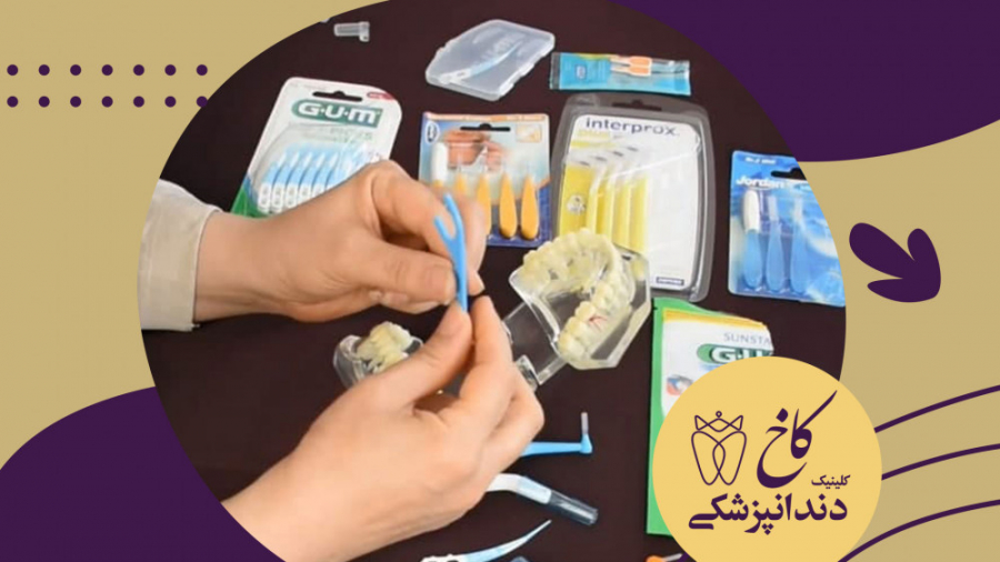 نخ دندان مسافرتی کلینیک دندانپزشکی کاخ