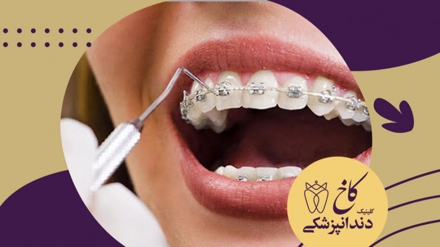 ارتودنسی دندان در کلینیک کاخ مشهد کلینیک دندانپزشکی کاخ