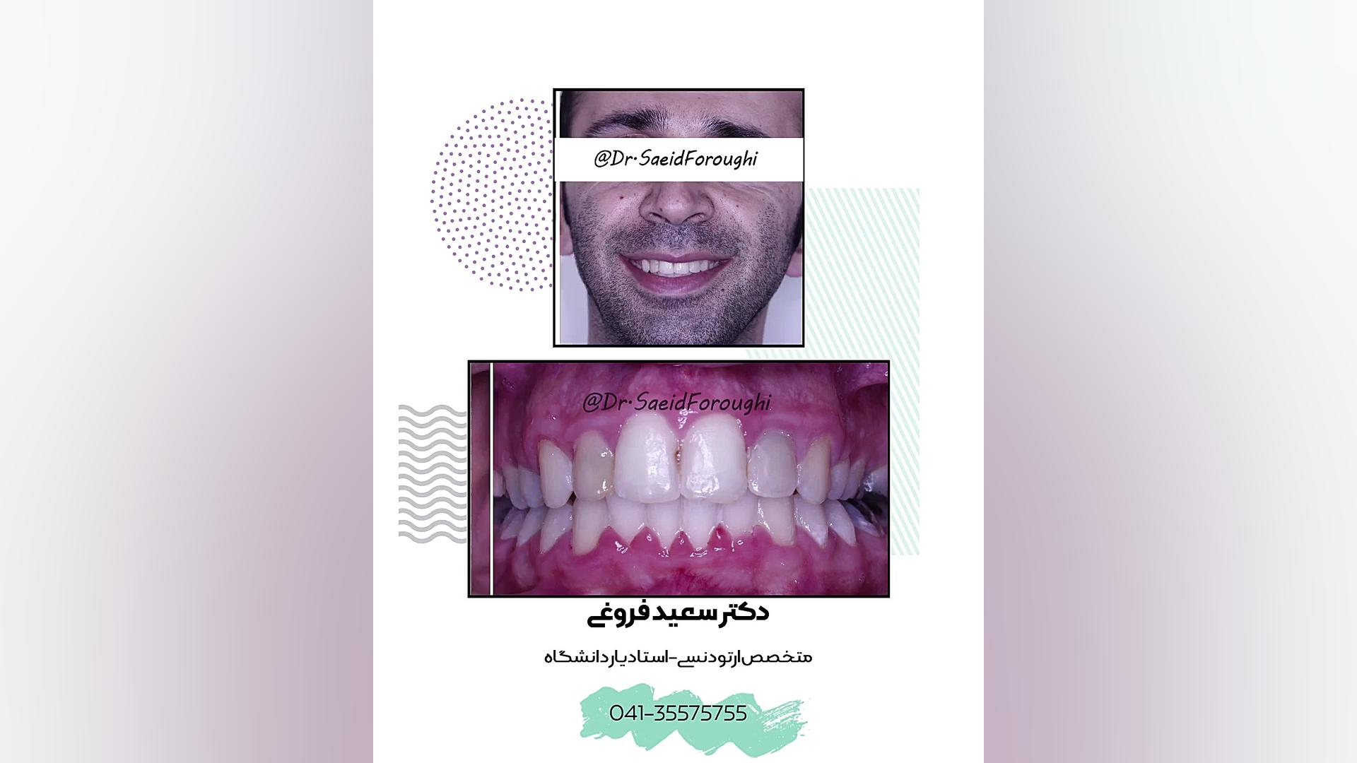 ارتودنسی دندان دکتر سعید فروغی متخصص ارتودنسی