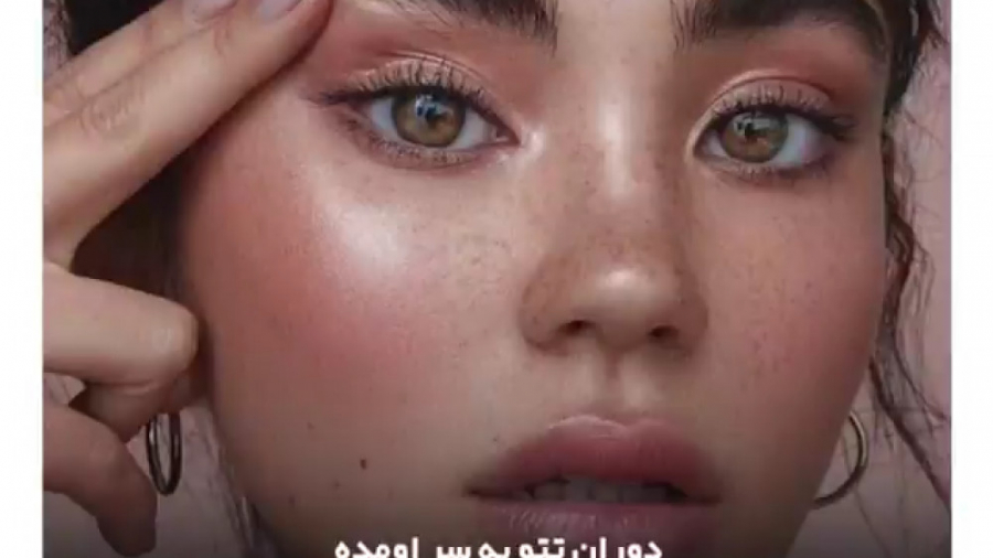 مقایسه تاتو ابرو میکروبلیدینگ و میکروپیگمنتیشن با کاشت ابرو ماکروسفالی