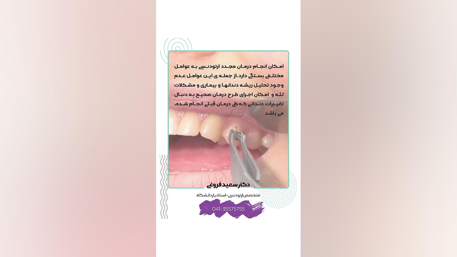 امکان انجام درمان ارتودنسی مجدد دکتر سعید فروغی متخصص ارتودنسی
