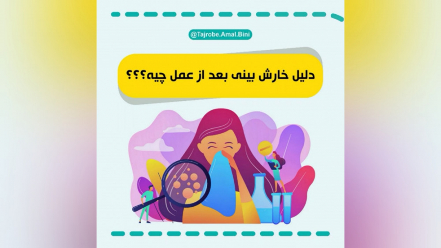 دلیل خارش بینی بعد از عمل بینی چیه؟؟؟ جراحی گوش