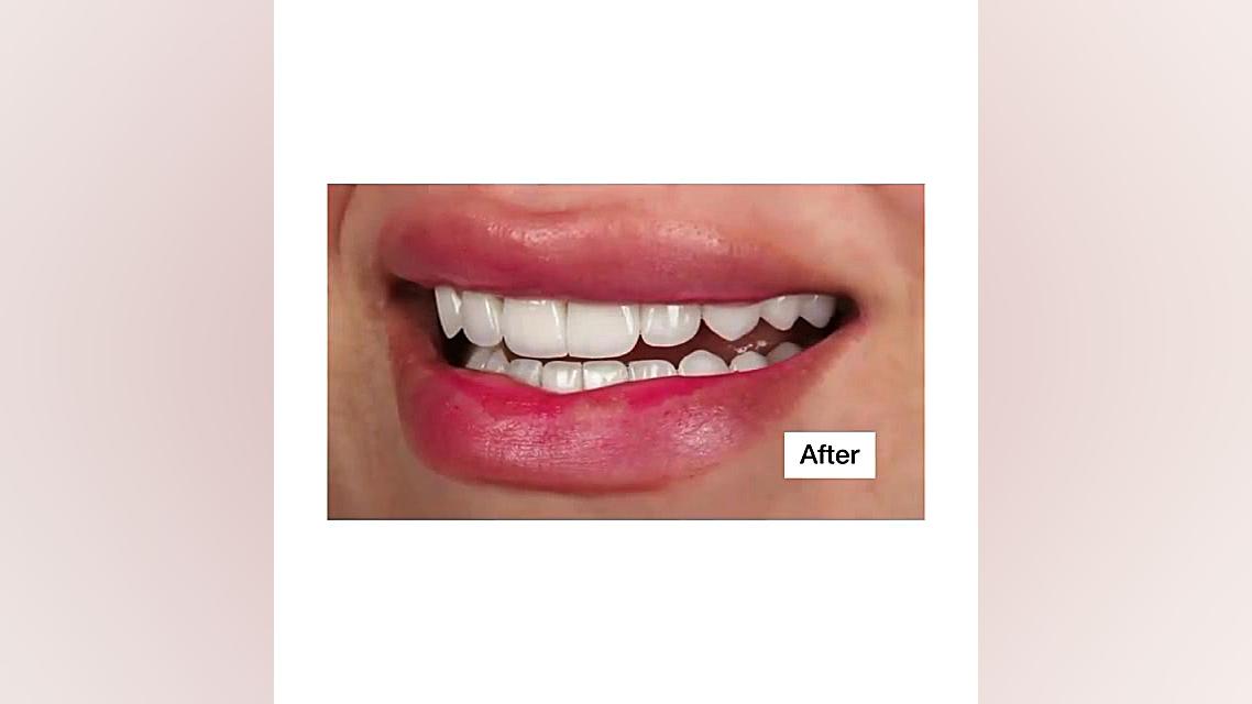 اصلاح طرح لبخند دکترمجیدقیاسی