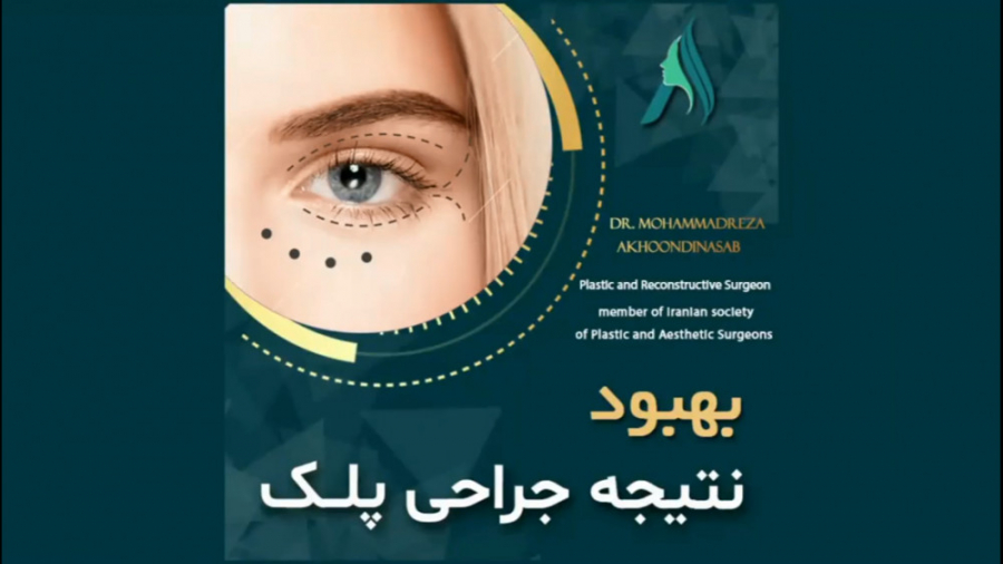 بهبود نتیجه جراحی پلک دکتر محمدرضا آخوندی نسب-فوق تخصص جراحی پلاستیک